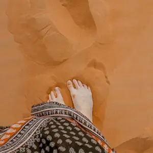 How does hard skin form?